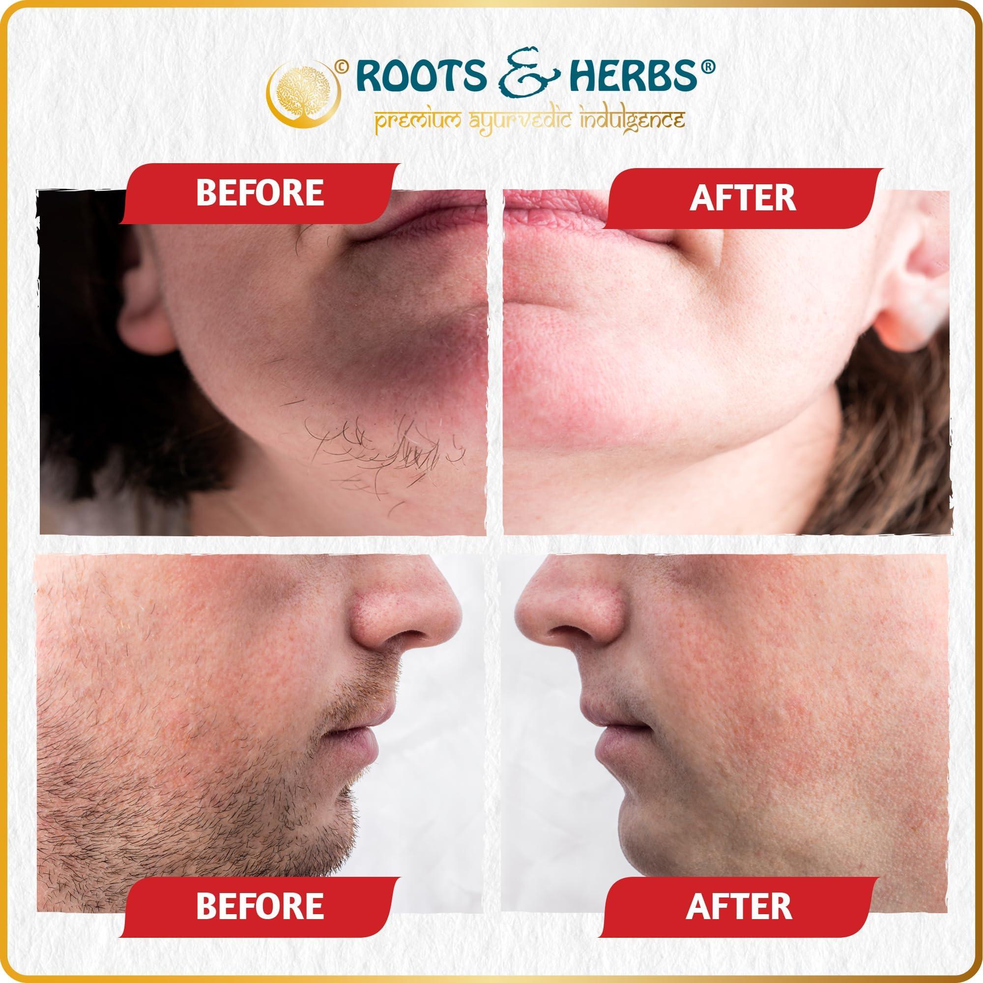 ROOTS AND HERBS Chickpea & Kasturi Turmeric Facial Hair Removal Powder - For Men & Women, Chin, Jawline & Upper Lips - Depilatory Mask with Ayurvedic Herbs - Roots & Herbs, 2.11oz