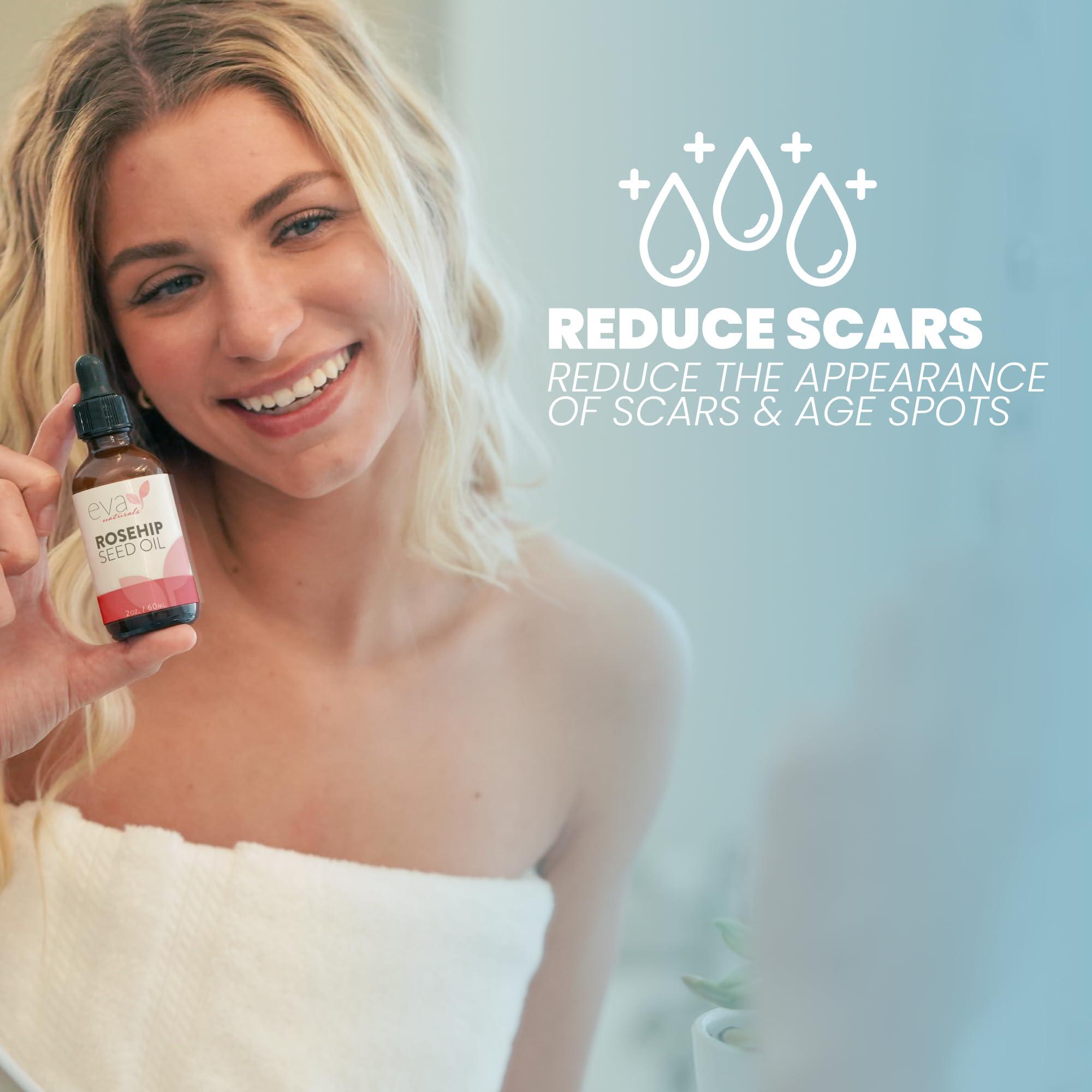 Eva Naturals Pure Rosehip Seed Oil (2 Fl Oz)- Rosehip Oil for Face Aids Stretch Mark and Scar Removal - Facial Oil Reduces Inflammation, Collagen for Radiant Skin - Face Oil - Best Rose Hip Oil for Face