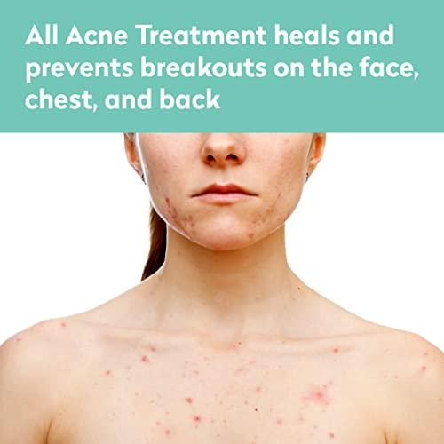 Dr. Blaine's All Acne Treatment - Face and Body - Spot and Full Coverage - Gel Formula - 9 Skin Boosters