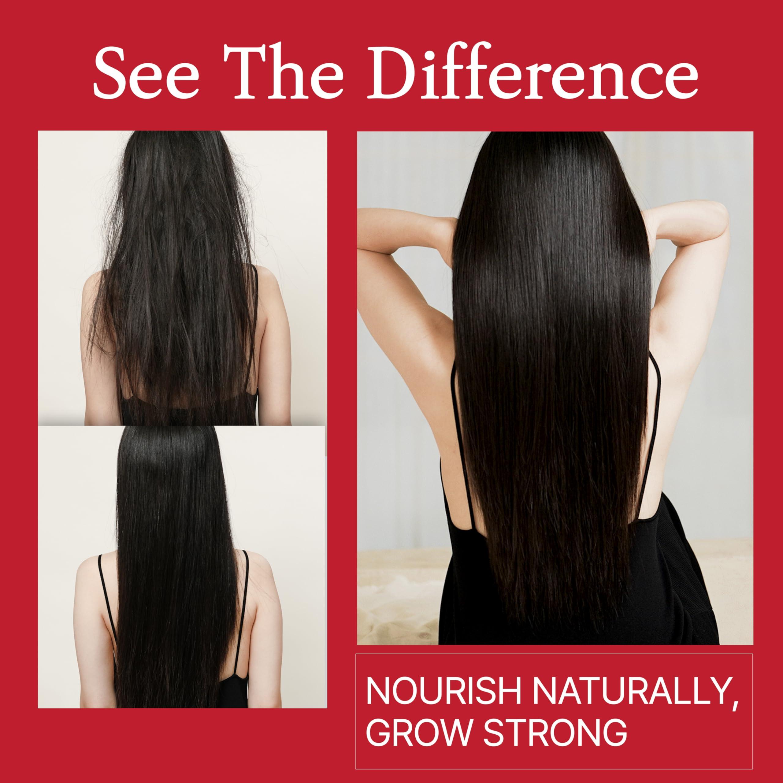 MOEV MOEV ANNURCATIN Shampoo and Conditioner Set for Women, Korean Biotin Hair Growth Volumizing Shampoo, Paraben-Free Natural Apple Wash-Off Hair Mask, Rose Thickening for Damaged Hair