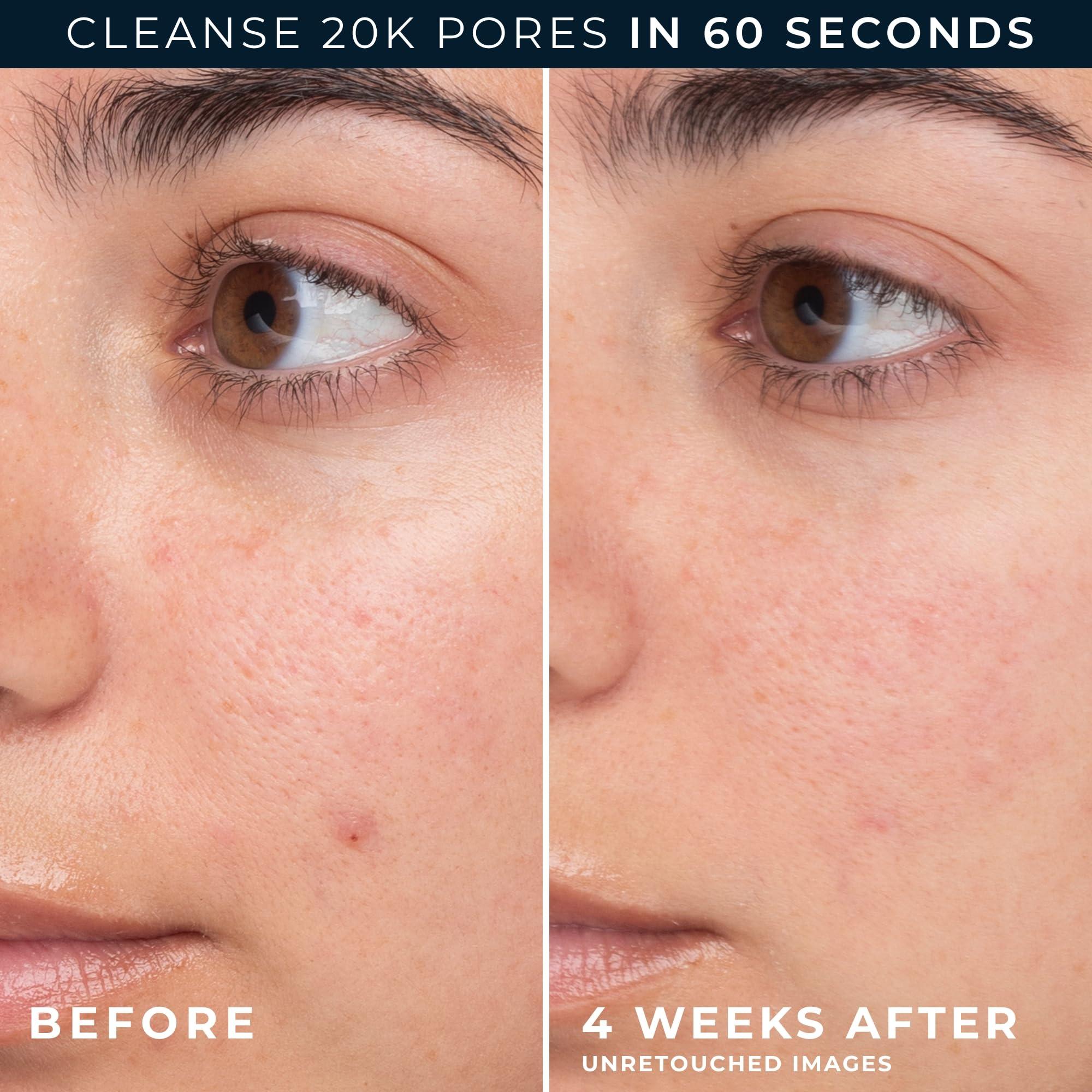 RoC RoC Barrier Renew Gel to Foam Non Drying Facial Cleanser to Hydrate Skin, 12 Ounces