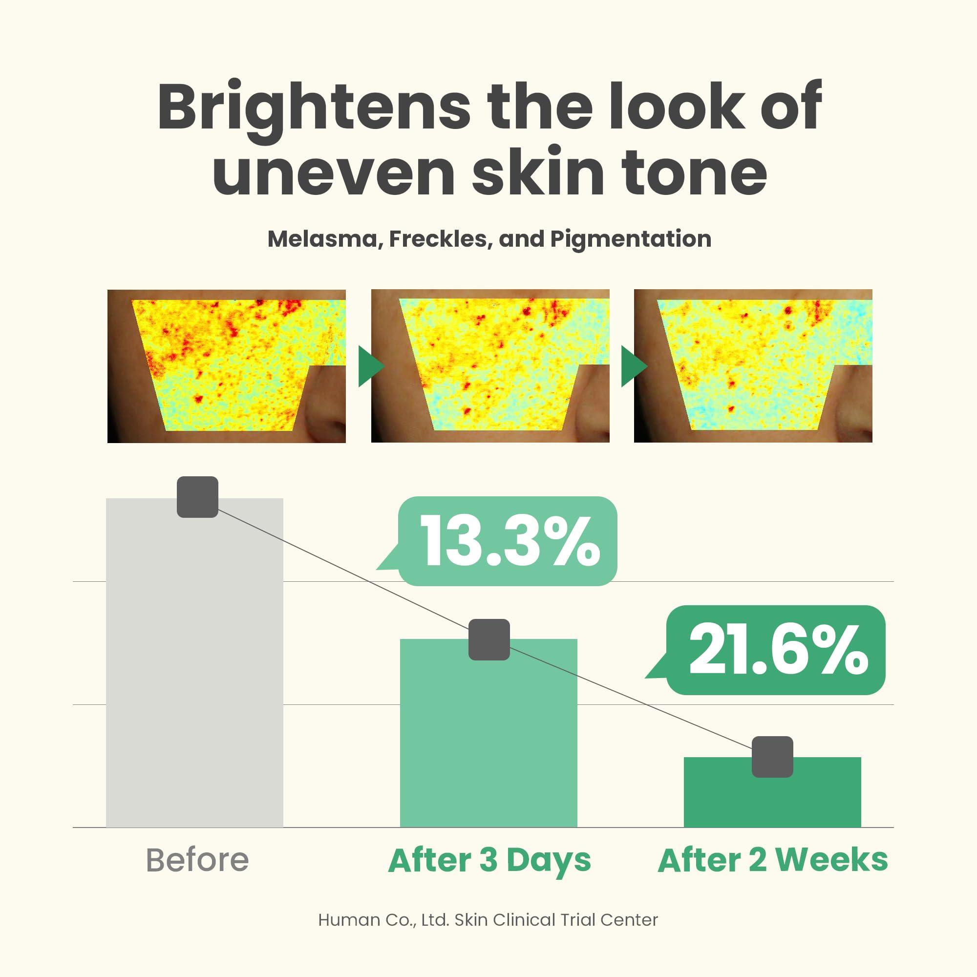 AXIS-Y AXIS-Y Dark Spot Correcting Glow Serum - 5% Niacinamide Remedy for Dark Spots, Blemish & Freckle Remover - Vegan Korean Skin Care Niacinamide Serum for All Skin Types - 1.69 fl. oz.