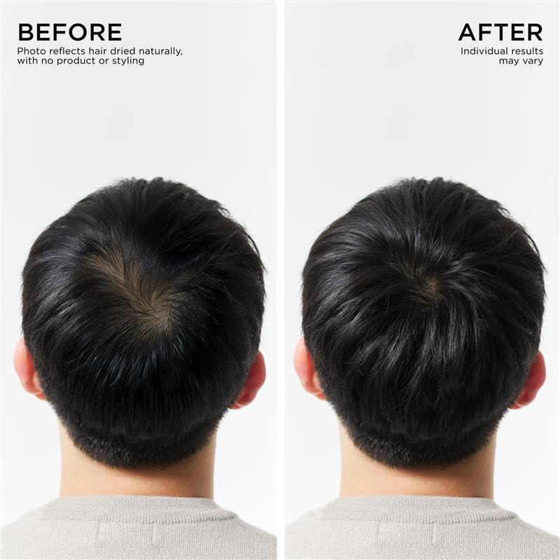 Dr. Groot Dr. Groot Hair Thickening Shampoo, Korean Hair Care with Biotin, Rosemary Oil to help Volumize Thinning, Damaged Hair, Hydrate Hair and Scalp, Biotin Shampoo,Scalp Revitalizing Solution