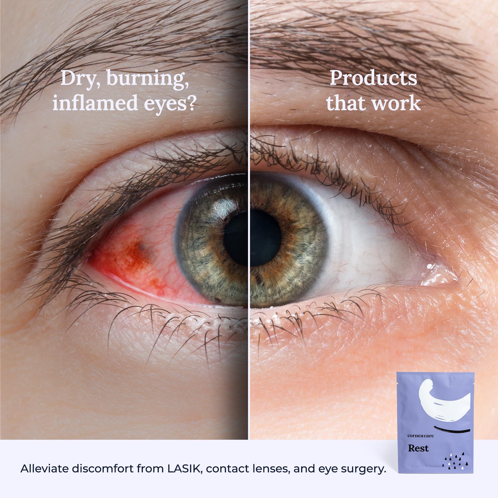 CorneaCare CorneaCare Rest: Self Heating Warm Compress for Dry Eyes | Heated Eye Mask for Fast Relief | No Microwave or Washcloth Needed | Travel Ready | 30 Count | FSA & HSA Eligible