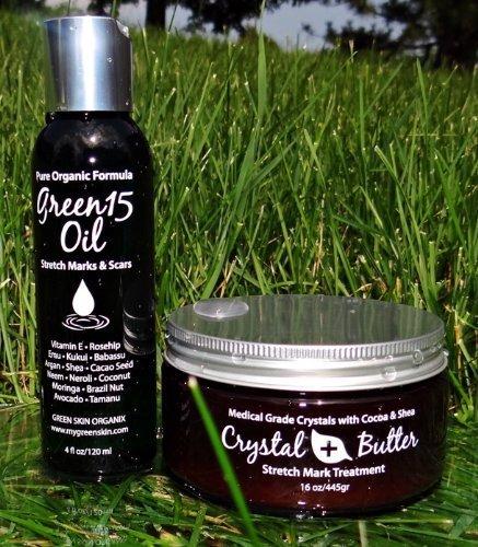 Green Skin Organix Best STRETCH MARK Complete Solution Kit- Medical grade microdermabrasion crystals mixed with Raw Cocoa Butter +organic 15 natural oils blend Stretch Mark COMPLETE KIT Microdermabrasion Crystal Butter & Green15 Oil shown to prevent and remove old stre