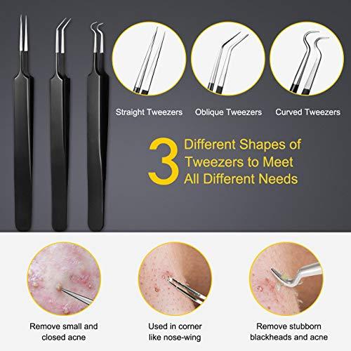 Boxoyx Pimple Popper Tool Kit - Boxoyx 10 Pcs Blackhead Remover Comedone Extractor Kit with Box for Quick and Easy Removal of Pimples, Blackheads, Zit Removing, Forehead,Facial and Nose (Black)