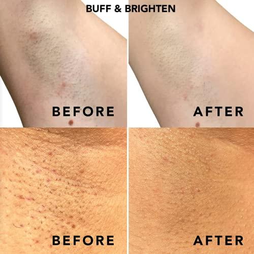 SweetSpot Labs SweetSpot Labs Ingrown Hair Removal Kit | Razor Bump & Ingrown Hair Treatment For Bikini Area, Body & Underarms | Safe for All Skin, Bump Eraser and Buff and Brighten Pads Set
