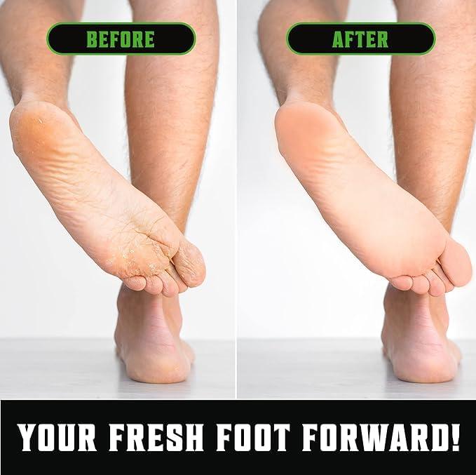 Viking Revolution Viking Revolution Tea Tree Oil Body Wash Soap for Men - Helps Athlete's Foot, Toenail, Jock Itch, Eczema, Ringworm & Body Odors - Extra Strength Men's Body Wash (2 Pack)