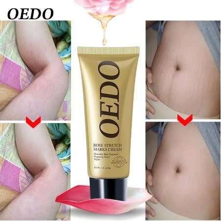 OEDO OEDO Rose Remove Stretch Mark Cream Nourish Anti-wrinkle Pregnant Women Skin Repair Remove Obesity Tattoo Body Care 40g