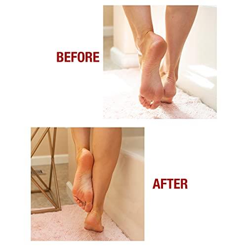 Kerasal Kerasal Intensive Foot Repair Skin Healing Ointment, 1 Oz and Zen Toes Moisturizing Gel Socks, One Pair