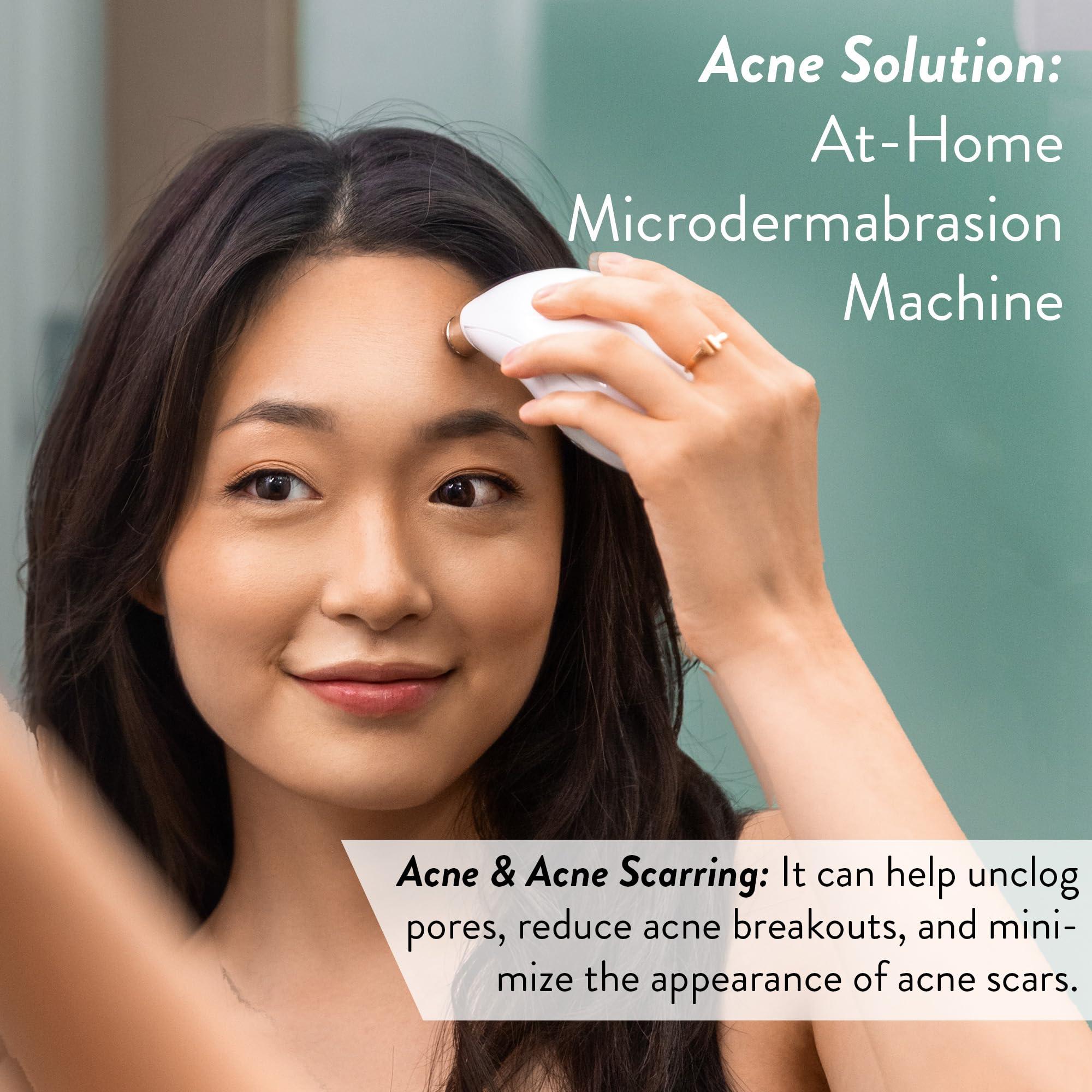 Microderm GLO Microderm GLO Diamond Microdermabrasion Machine - Best Gift for Women - Dermabrasion & Anti Aging Wrinkle Skincare - Home Facial Treatment System - Blackhead Remover & Exfoliator for Acne Scars