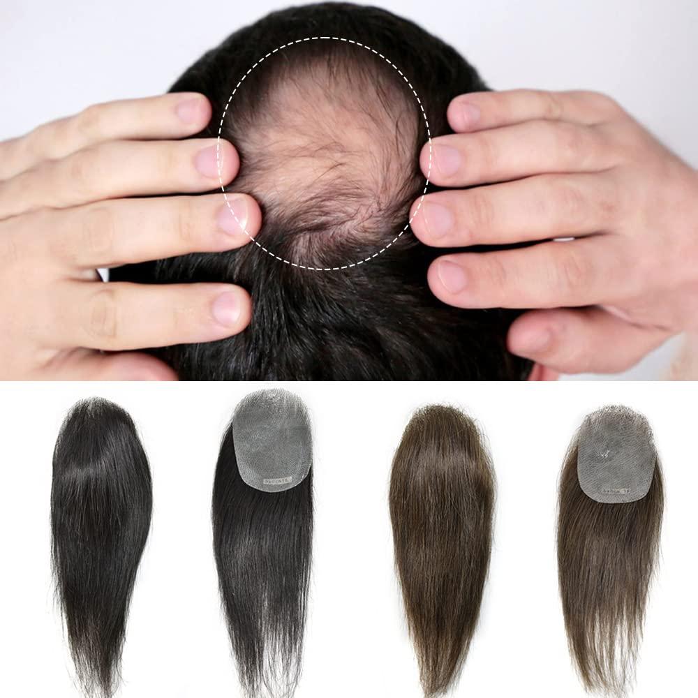 Generic Bald Spot Hair Patch V-Looped Remy Human Hair Patch For Bald Spot Natural lookimg hair Patch For Men Thin Skin Hair Patches For Bald Spots (6cm x 8cm-6\", 3 DARK BROWN)