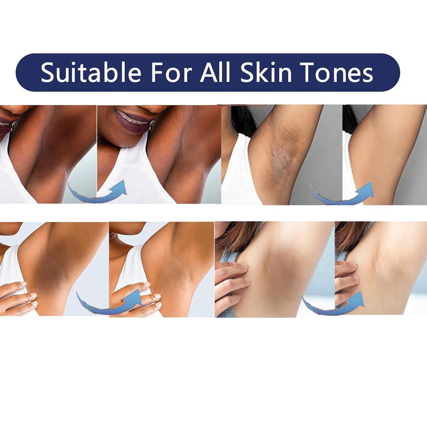 Gukei Gukei Intimate Areas Skin Lightening Cream Skin Bleaching Cream For Body Sensitive Intimate Area, Private Parts, Underarm, Knees, Elbows, Inner Thigh, Bikini Areas, Natural Skin Whitening Cream.
