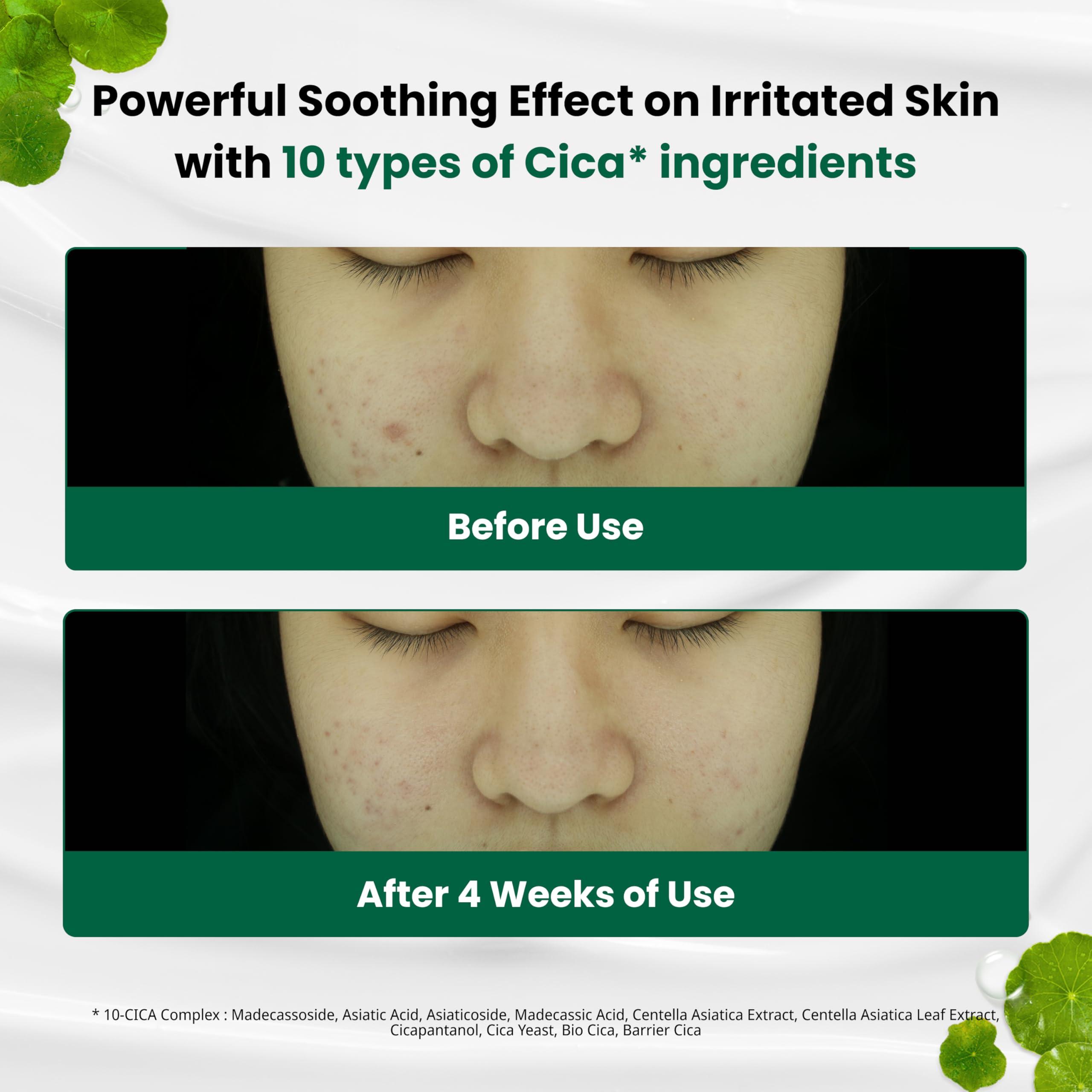 Dr.G Dr.G Red Blemish Clear Soothing Korean Moisturizer Face Cream, 70ml - Cica Cream, Korean Skin Care Moisturizer, Korean Face Moisturizer, Facial Moisturizer, Korean Skincare, K Beauty Skincare Coreano