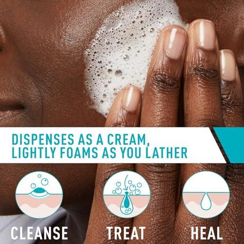 CeraVe CeraVe Acne Foaming Cream Cleanser, 4% Benzoyl Peroxide Face Wash With Hyaluronic Acid, Niacinamide & Ceramides, Gentle Daily Acne Treatment For Face