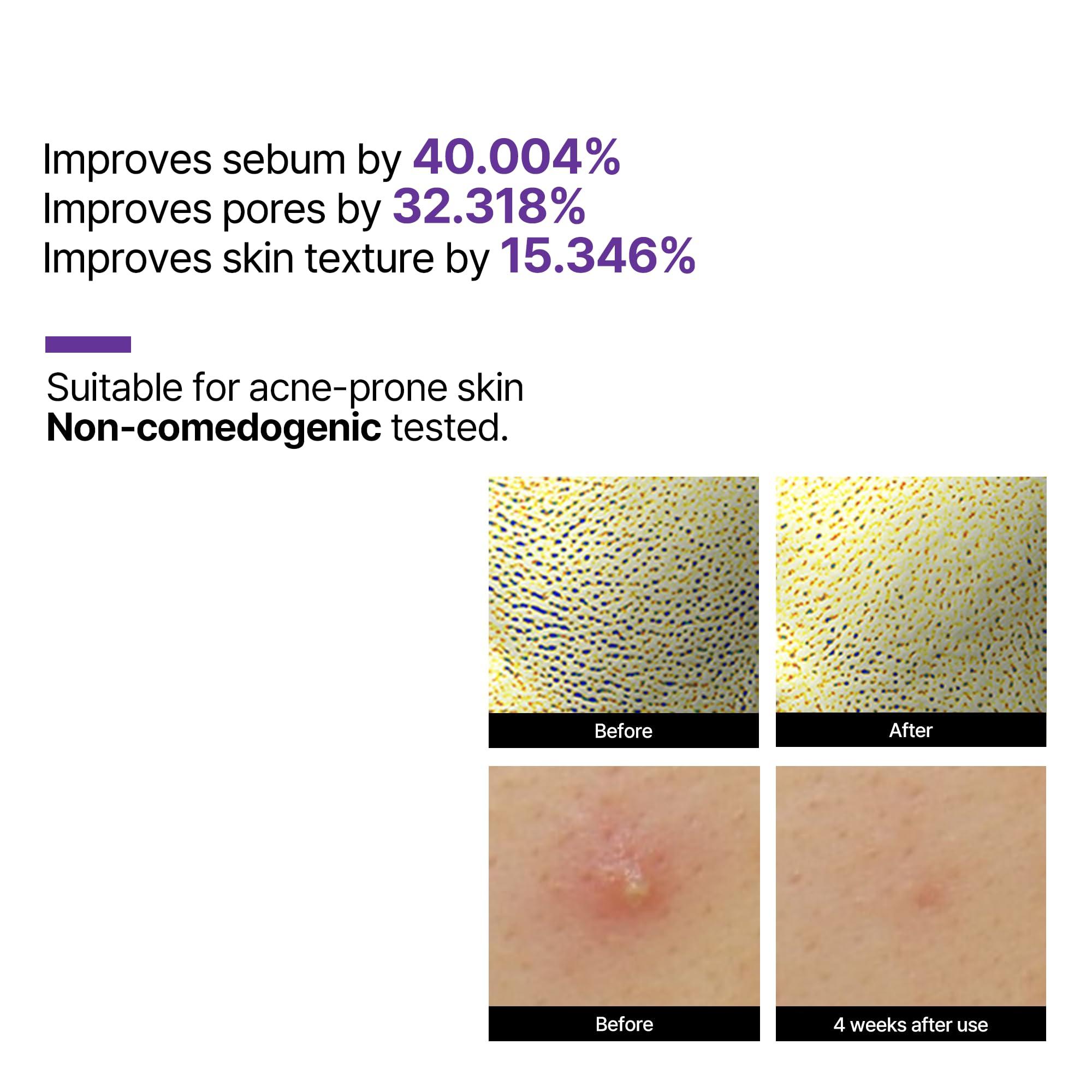 SOME BY MI SOME BY MI Retinol Intense Reactivating Serum 50ml + Retinol Intense Advanced Triple Action Eye Cream