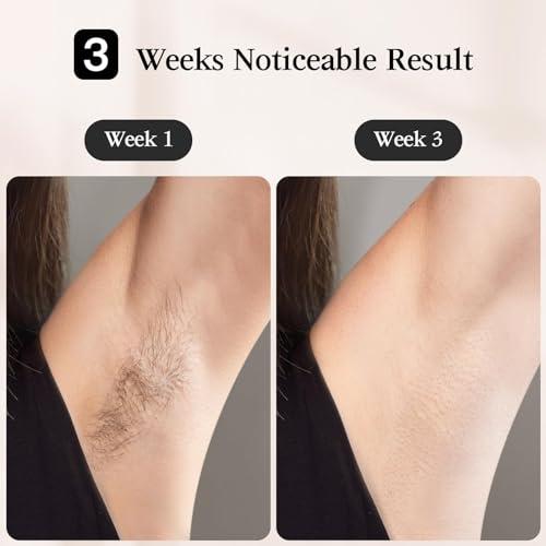 JOVS JOVS Laser Hair Removal, [24J Energy] IPL Hair Removal for Women and Men, 37F Painless Sapphire Ice-Cooling Tech, 6 Modes for Whole Body Hair Removal Device, 2 in 1 Skin Rejuvenation, 330 Rotation