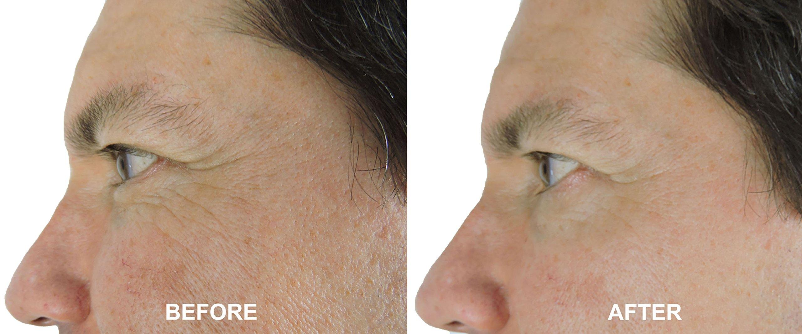 DNA CODE Skin Care Magic Night Cream-No Needle Alternative-Best Argireline Peptides Overnight Firming Cream-Argireline, Matrixyl 3000, SNAP-8, Pentapeptide-18 (Leuphasyl), SYN-AKE, Copper Peptide,Syn-Coll, Syn-Tacks