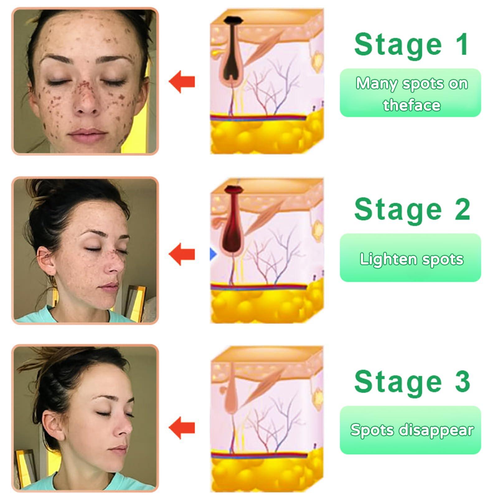 Luhaka JORONDY Purifying Peel Gel, purifying peel, deep cleans and moisturizes the skin, effective exfoliation