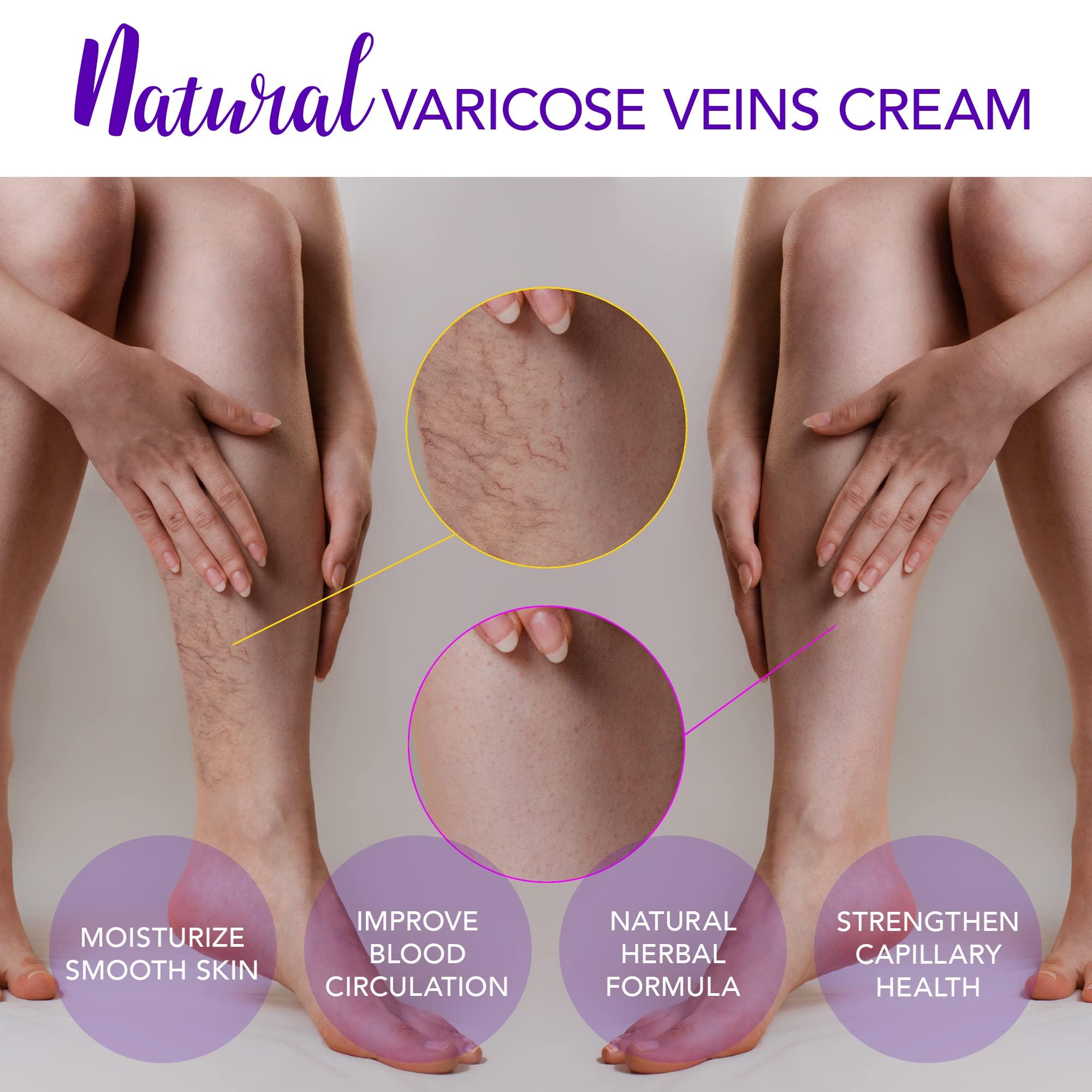 PAULINRISE PAULINRISE Varicose Vein Cream for Legs - Improves Blood Circulation, Reduces Spider Veins and Heaviness, 2 Oz