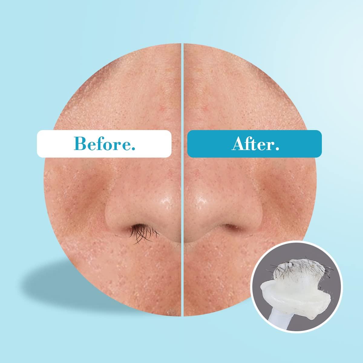 OAKEER Oakeer Nose Wax Kit - 40 Sticks, Hair Remover for Men & Women, Ears & Nose, with 20 Paper Cups & 100g Wax