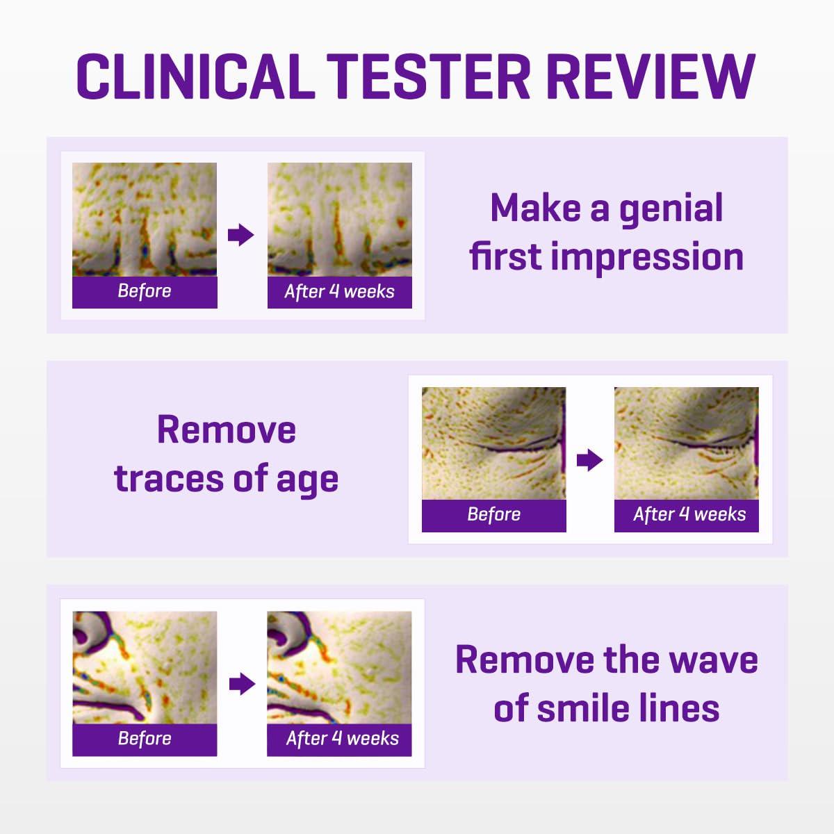 SOME BY MI SOME BY MI Retinol Intense Reactivating Serum 50ml + Retinol Intense Advanced Triple Action Eye Cream