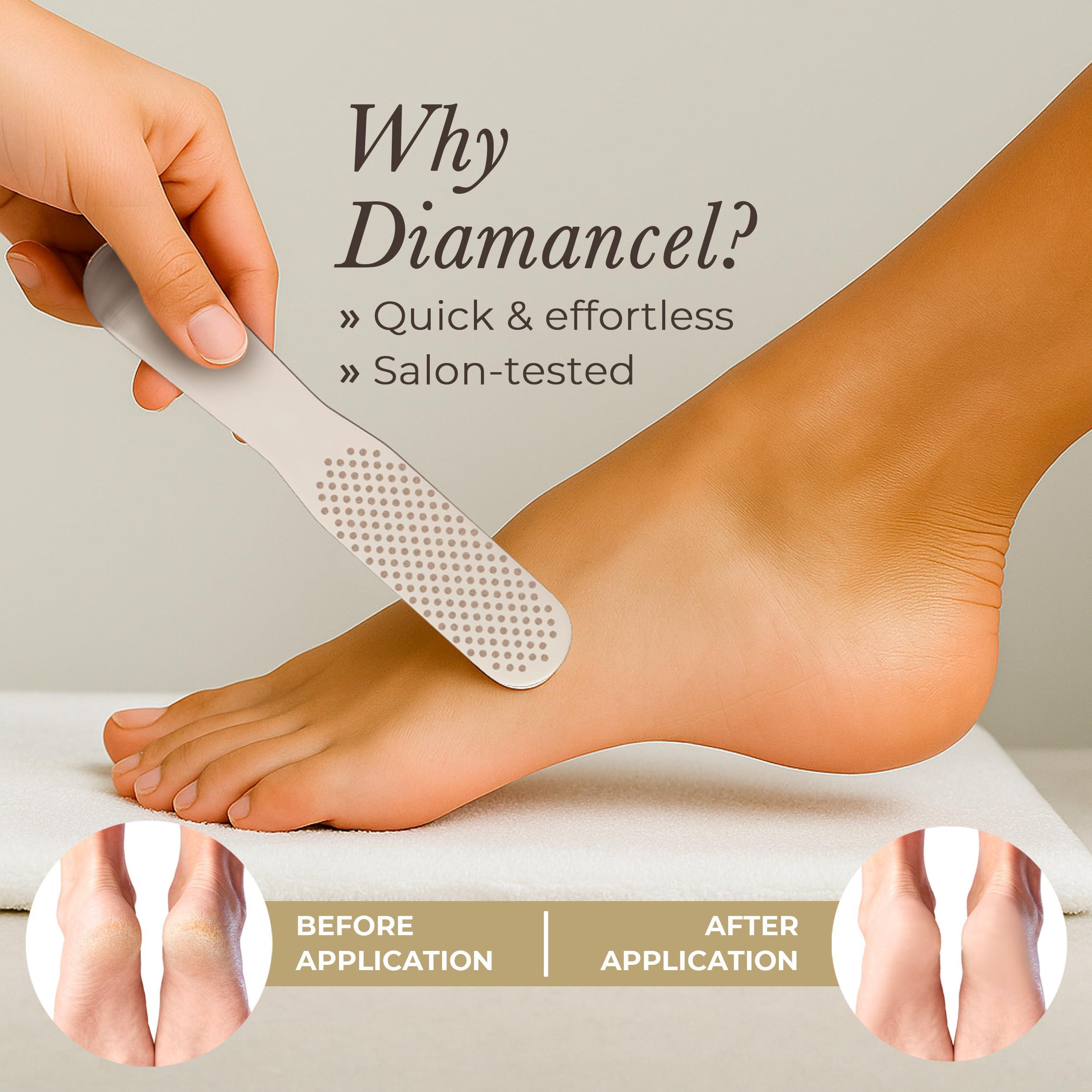Diamancel Diamancel Luxury Diamond Foot Buffer - Coarse Grit  For Large Calluses & Rough Skin - #20 (no handle)