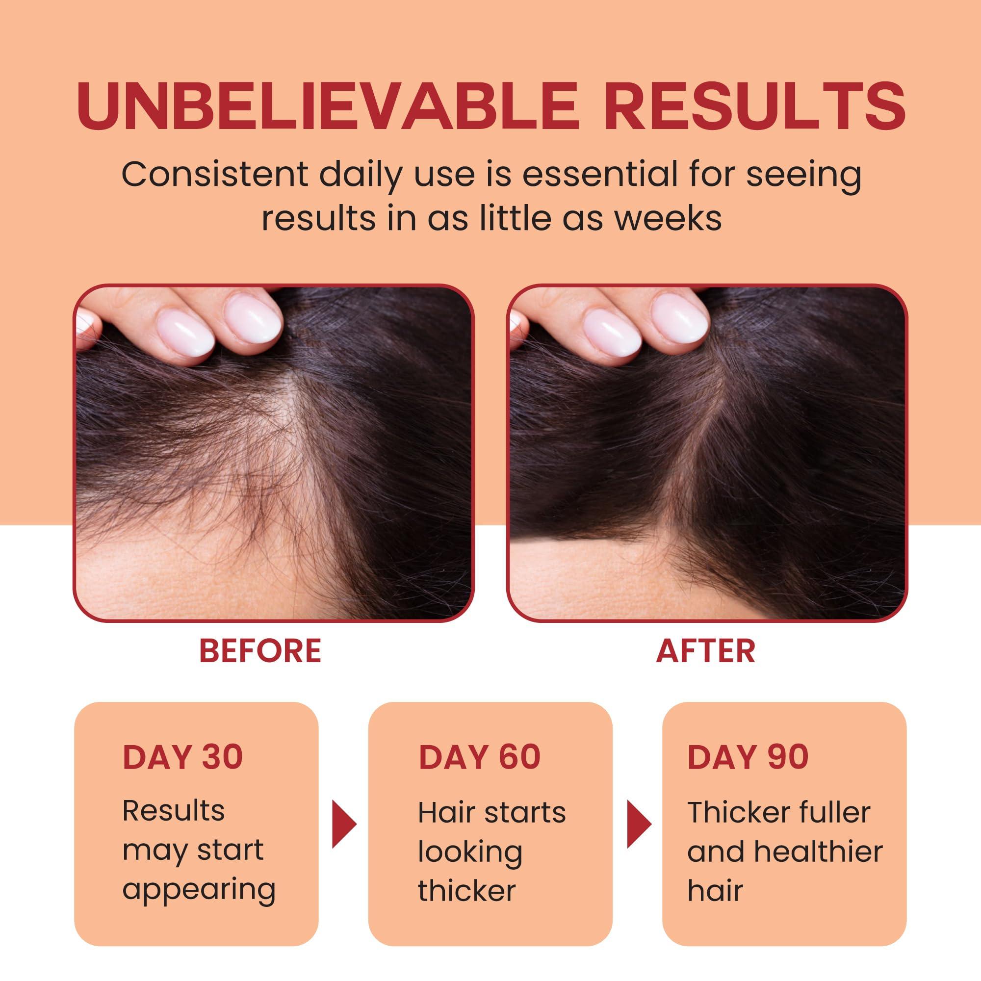 Lebanta Lebanta Raw Batana Oil for Hair Growth - 100% Pure, Organic 4oz Batana from Honduras for Thick and Strong Natural Hair - Dr. Sebi Unrefined Cold Pressed Cosmetic Scalp Mask for Men & Women (1 Pack)