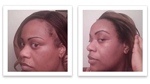 Caboki Caboki All-Natural, Plant-Based Hair Concealer Covers Bald Spot and Thinning Hair. (16G, 40-Day Supply). Black