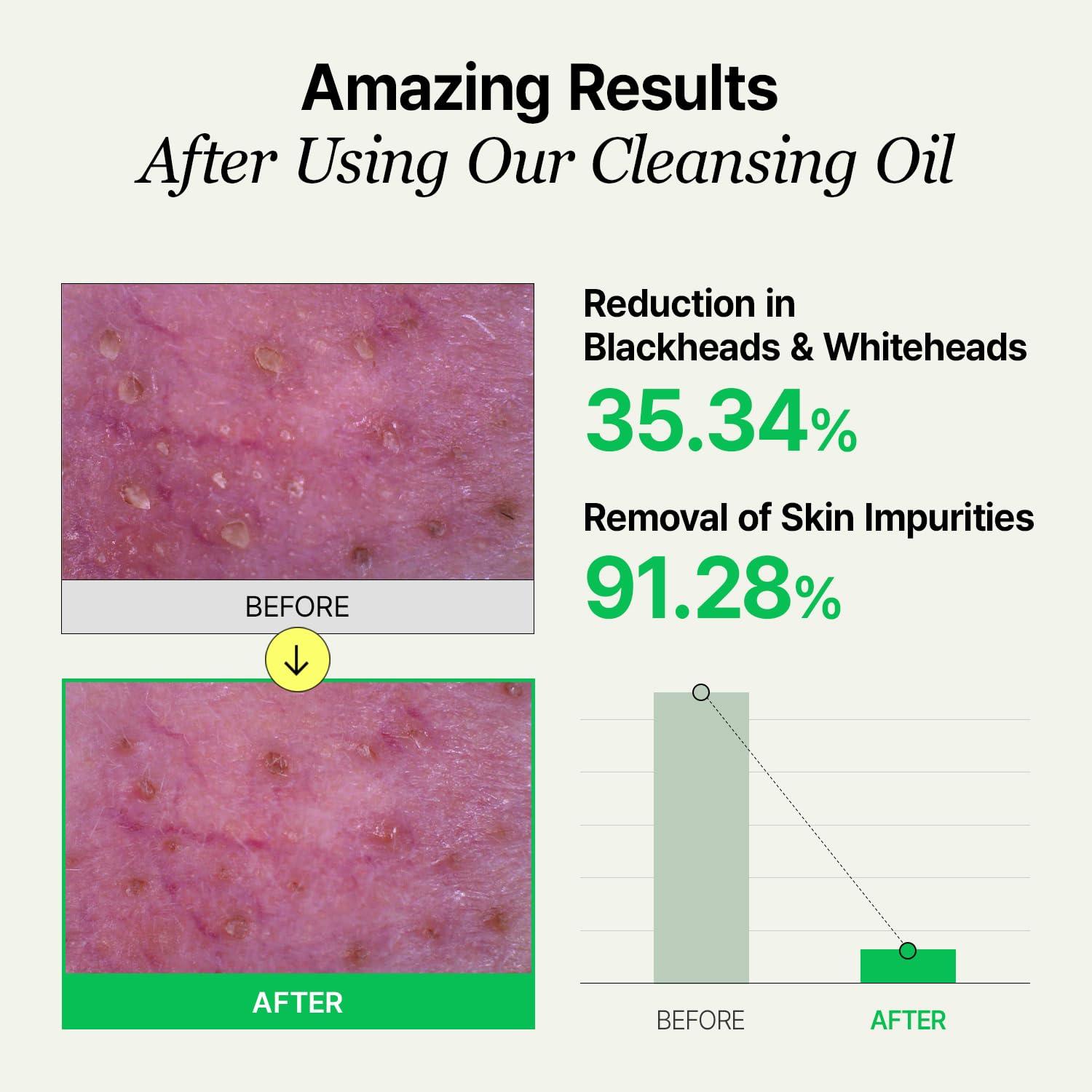 VEGANIFECT VEGANIFECT LHA Deep Cleansing Oil, Makeup, Blackhead and Whitehead Remover, Korean Skin Care, Vegan, 6.93 Fl Oz