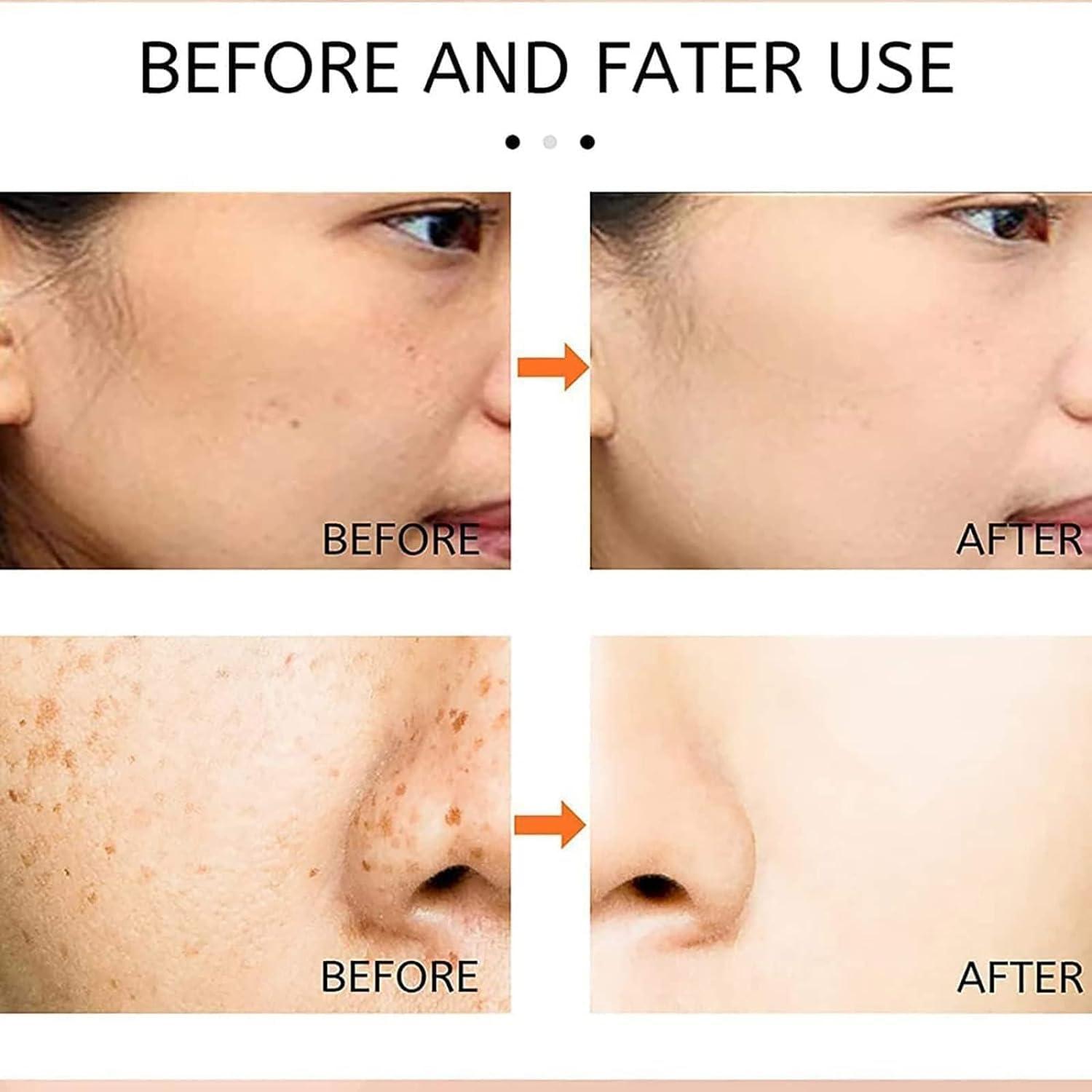 HEKEWER 2024 New Face Cream,Renewal Face Cream, Cosmetic Cream, Moisturizer Face Cream for Dry & Sensitive Skin (1PCS)