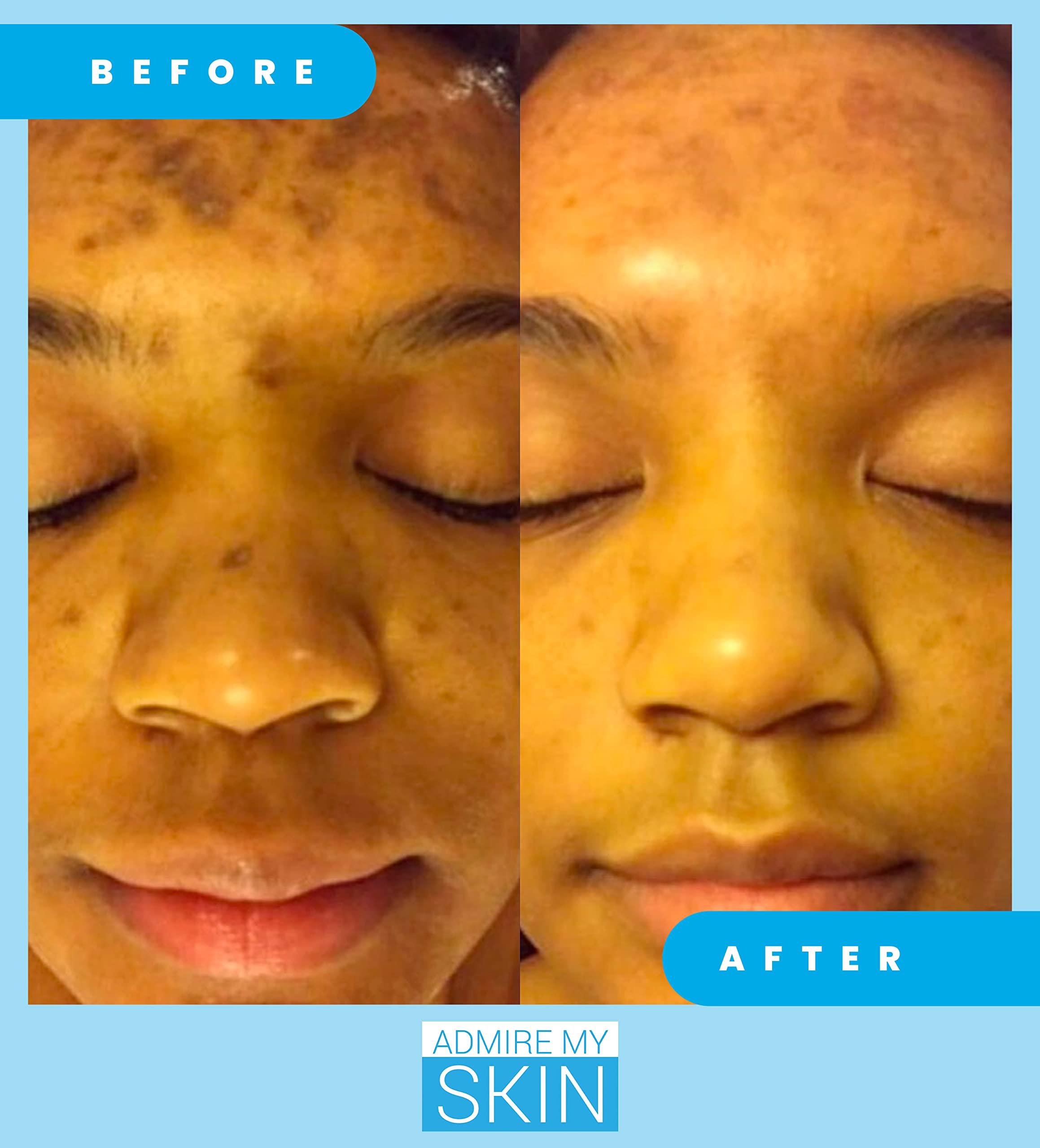 Admire My Skin Admire My Skin Dark Spot Corrector Serum + Retinoid Cream Set