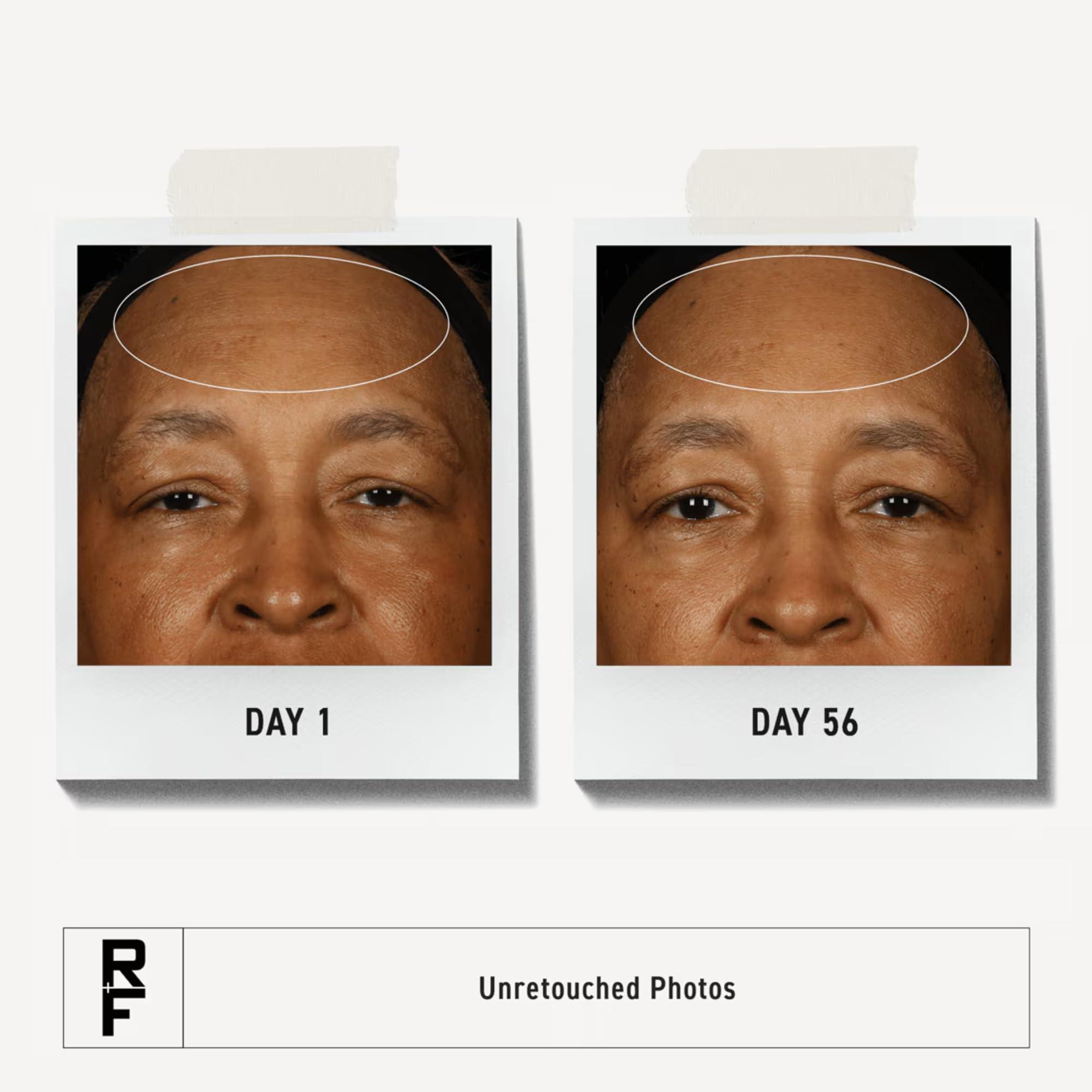 RODAN + FIELDS Rodan + Fields Redefine Regimen | Skincare Kit Includes Clay Cleanser, Toner, Triple Defense Cream, & Overnight Cream | Skin Care Gift Set for Women