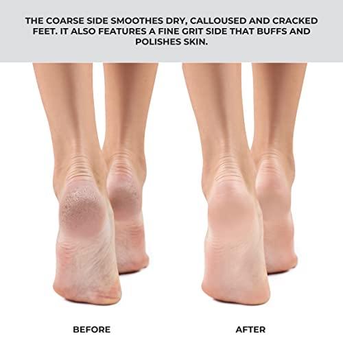 ForPro Professional Collection ForPro Pro Fusion Stainless Steel Pedi File - Coarse, Double-Sided Professional Quality - Blue Handle Pedicure File for Heels and Feet - 8.25” L