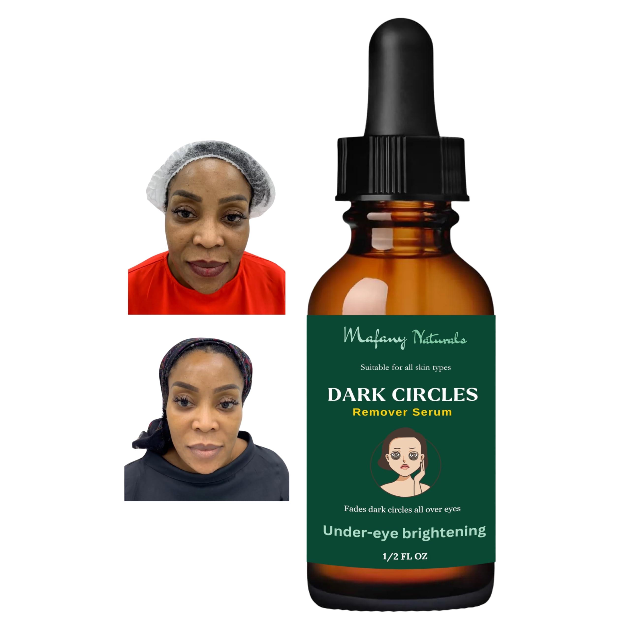 Unique Formulas Dark circles, Dark Under Eye Serum, Dark Circles Eraser serum 0.5 FL OZ