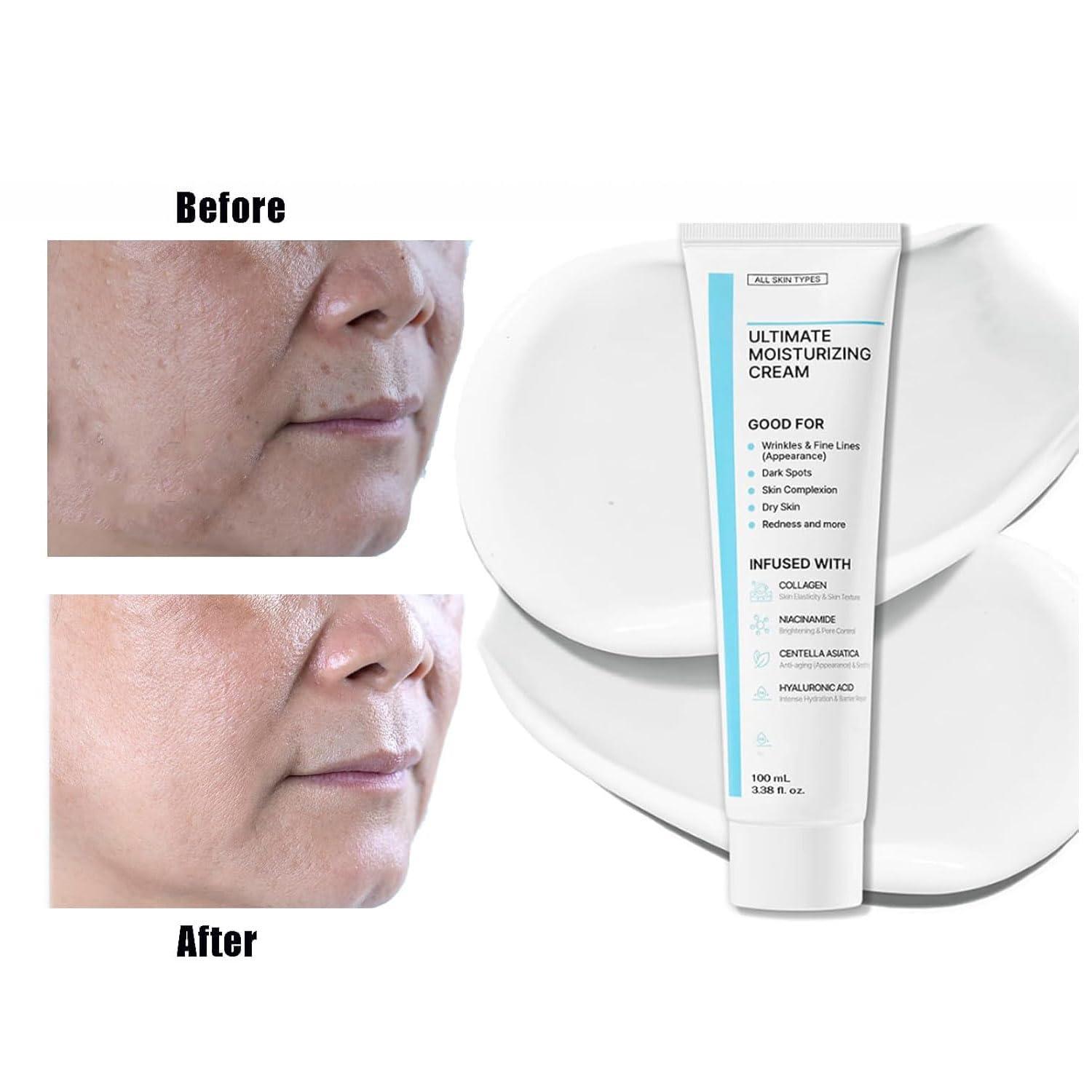 Generic Youthful Formula Ultimate Moisturizing Cream, Nida Youthful Formula Moisturizing Cream, Ultimate Moisturizing Cream, Nida Crema Coreana, Calming Face Moisturizer, Repairing Face Moisturizer (3)