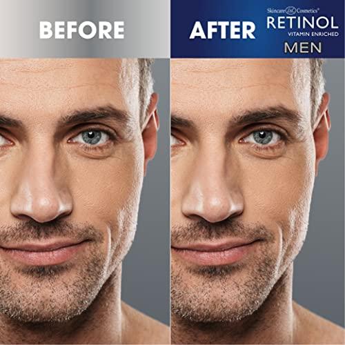 Retinol Retinol Men Facial Wipes Anti-Aging Cleansing Towelettes - Quickly cleanse face from sweat, oil and pore-clogging dirt without any heavy residue