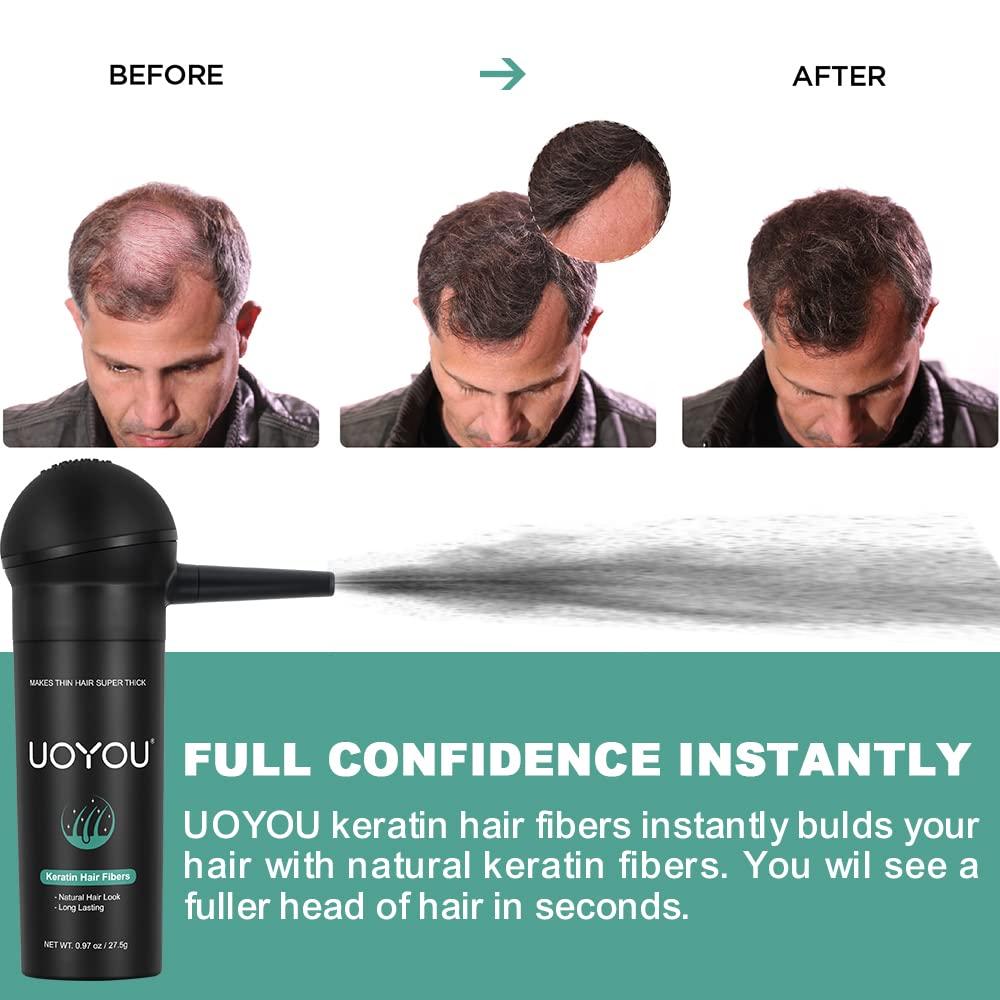 UOYOU BLACK Hair Fibers for Thinning Hair 27.5g Bottle with Applicator | Undetectable & Natural Keratin Hair Fibers Concealer for Hair Loss for Men and Women | Hair Building Fibres Powder [BLACK Hair Fiber]