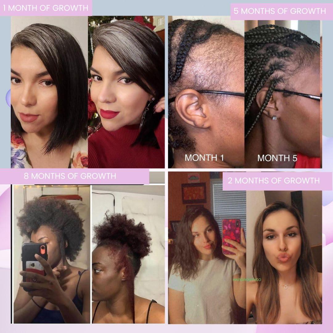 Hair Growth Co African Chebe & Rice Water Leave-In or Rinse Growth Conditioner 8oz I Formulated for Extreme Hair Growth