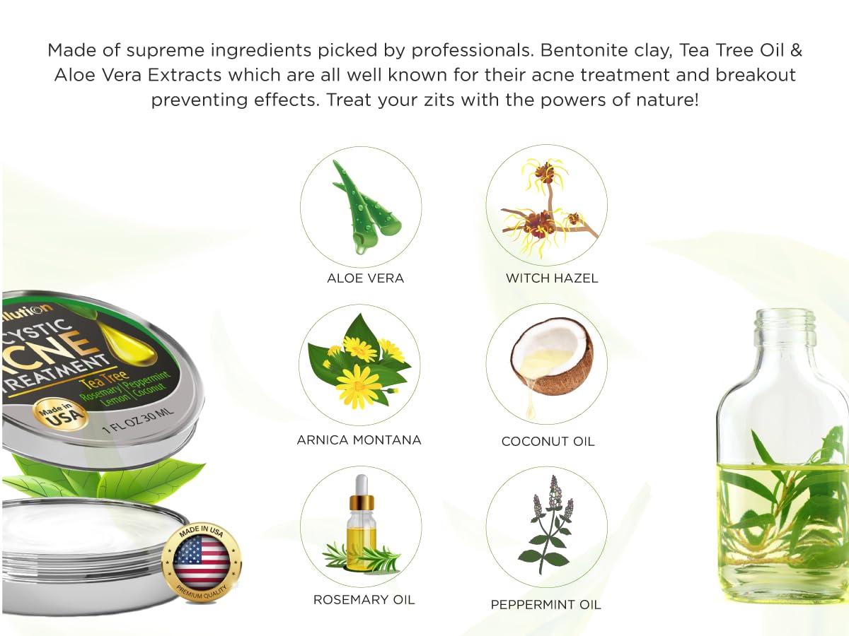 WELLUTION Wellution Cystic Acne Treatment Cream - Natural Pimple and Scar Remover with Tea Tree Oil - Effective Overnight Face Treatment for Acne Spots, Pimples and Scars - 1oz