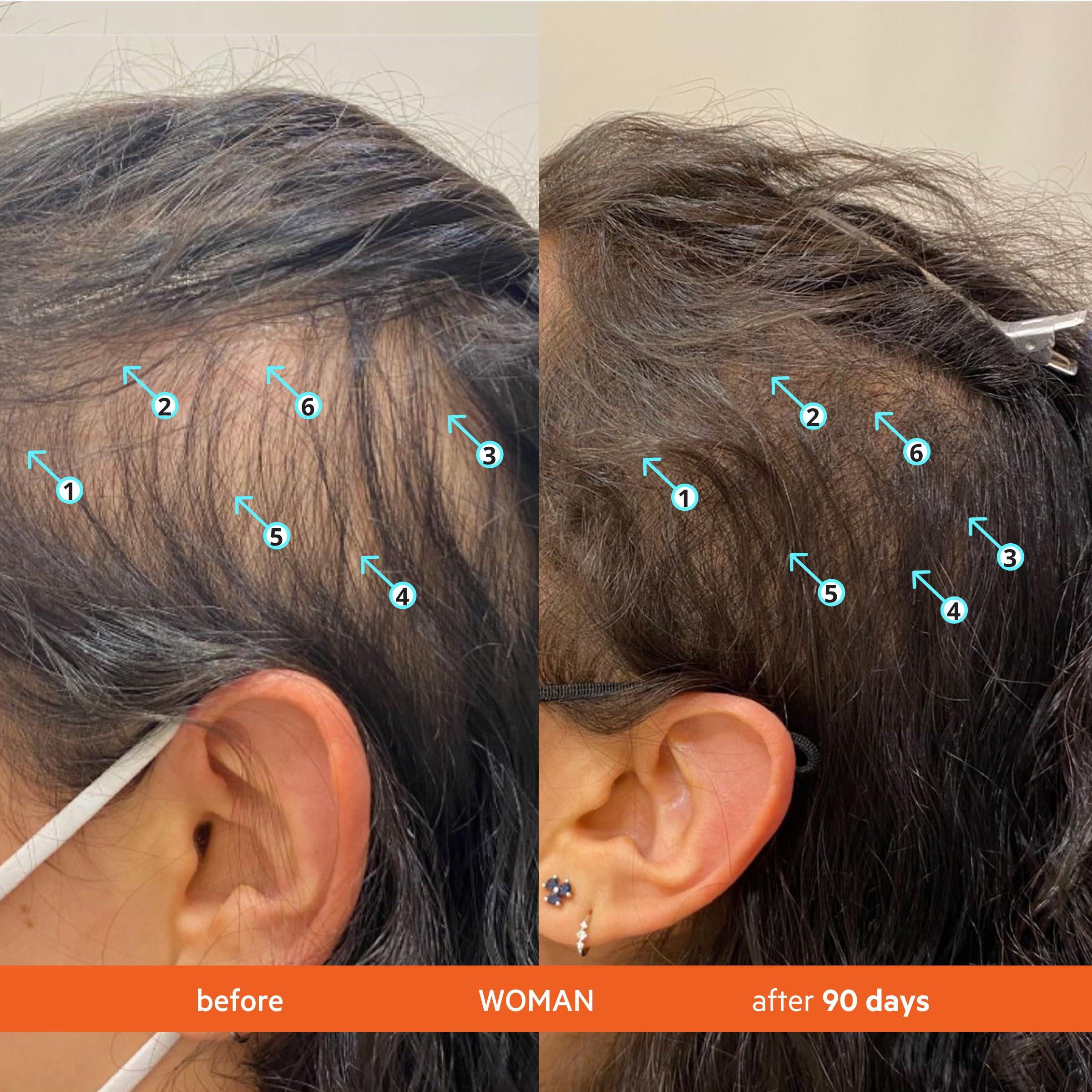 DS LABORATORIES DS Laboratories Revita Shampoo and Conditioner Set, Hair Thickening Shampoo and Conditioner to Support Hair Growth, Sulfate Free Shampoo and Conditioner with Biotin, Caffeine & DHT Blocker, Hair Care