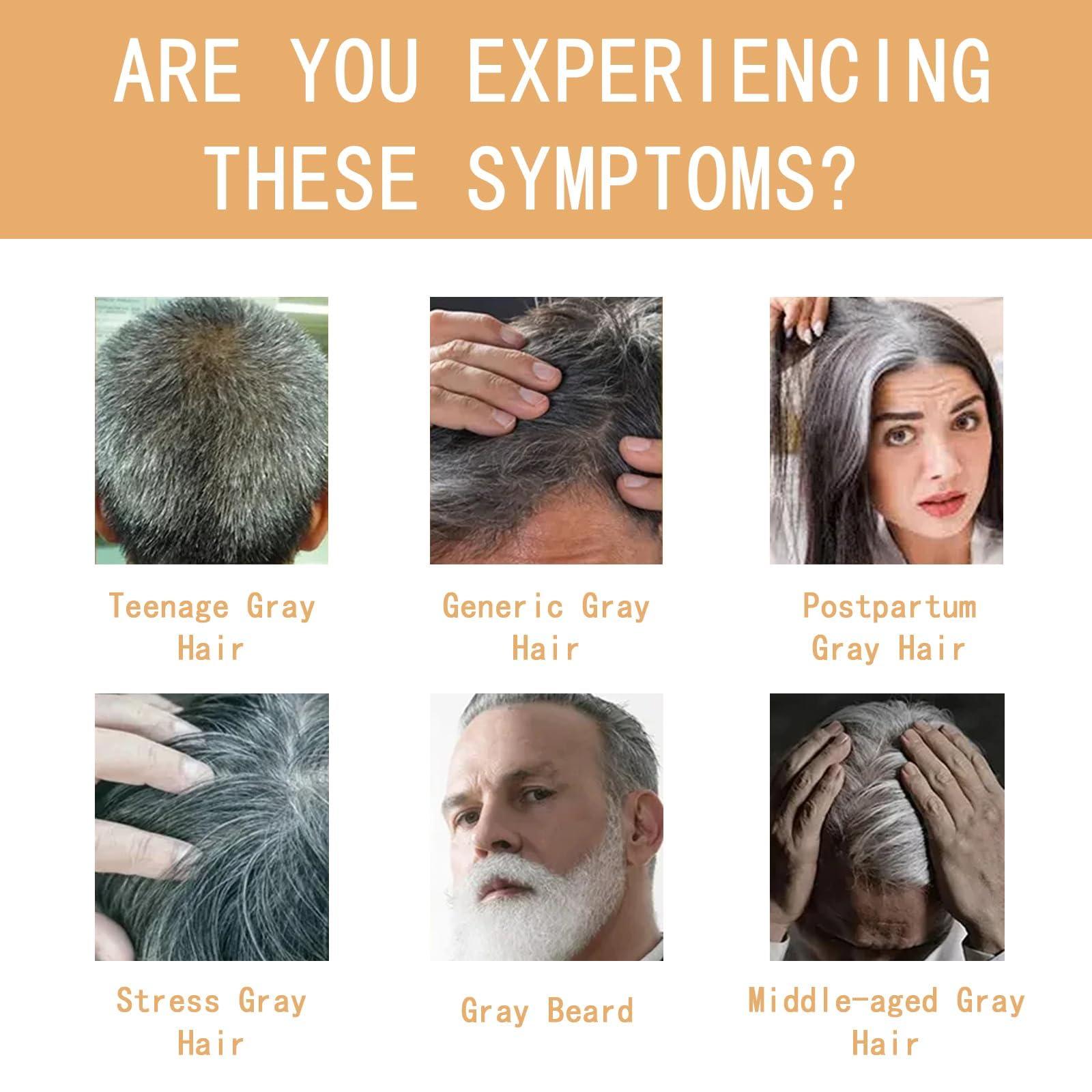 FROBON Gray Hair Reverse Bar(2 pcs)Grey Hair Shampoo Bar for Men and WomenBlack Soap for Grey Hair,Hair Darkening Soap-Deeply Nourishing Ingredients