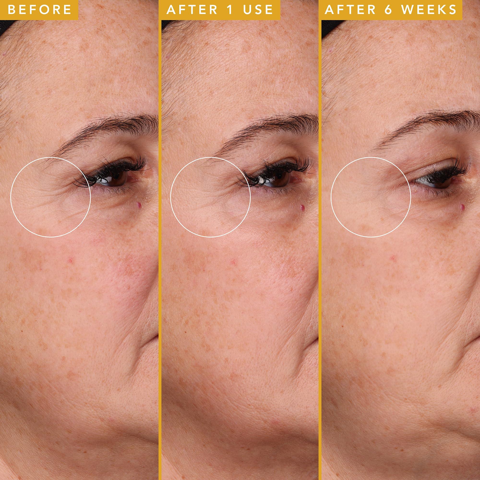 Farmacy Farmacy Filling Good Hyaluronic Acid Serum for Face - Anti Aging Skin Care + Hydrating Face Serum - Plumps, Smoothes & Helps to Visibly Improve Skin Firmness for a Youthful Complexion (5ml)