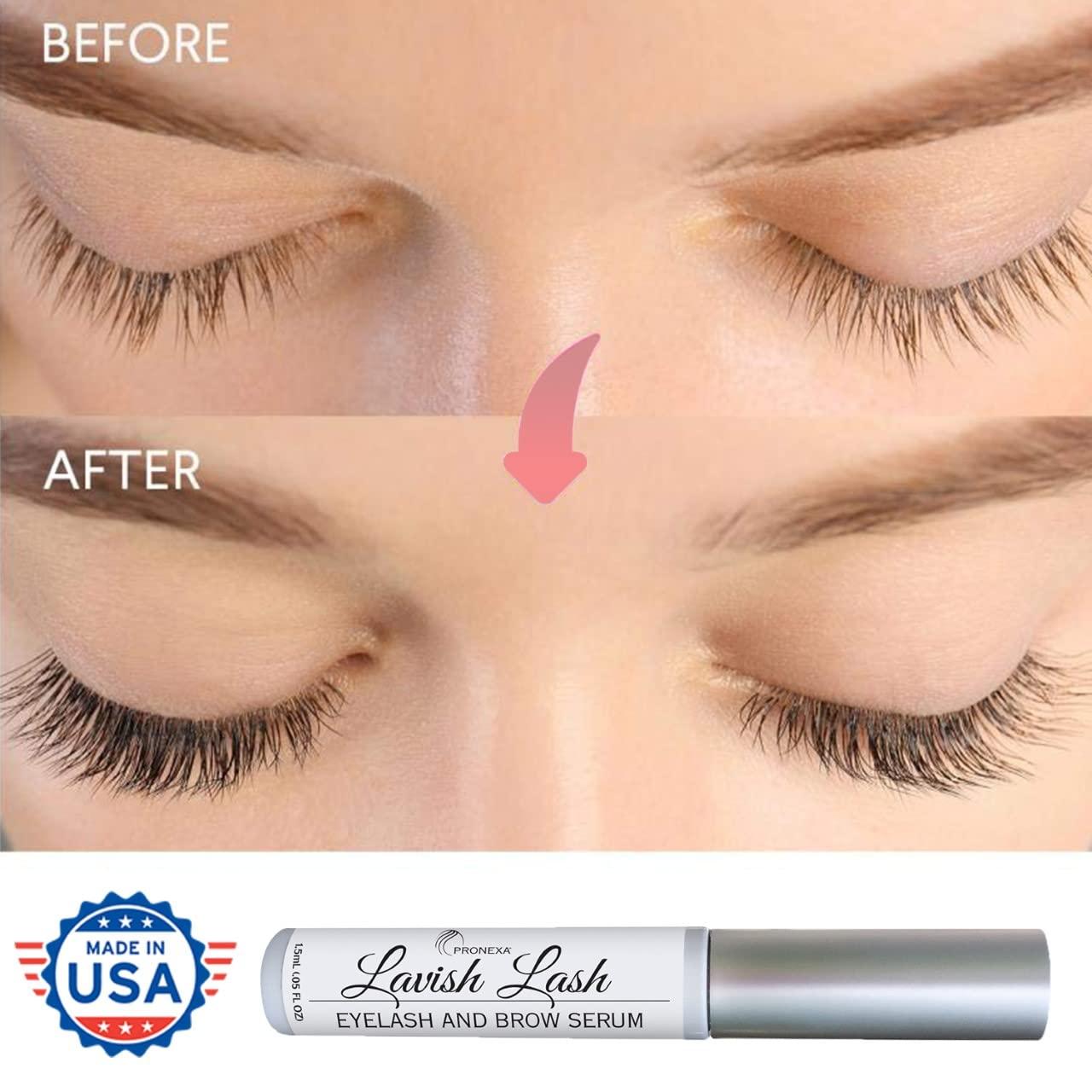 Pronexa Pronexa Hairgenics Lavish Lash (3ml, 3 Month Supply) Eyelash Growth Enhancer & Brow Serum with Natural Peptides for Long, Thick Lashes and Eyebrows! Dermatologist Certified & Hypoallergenic.