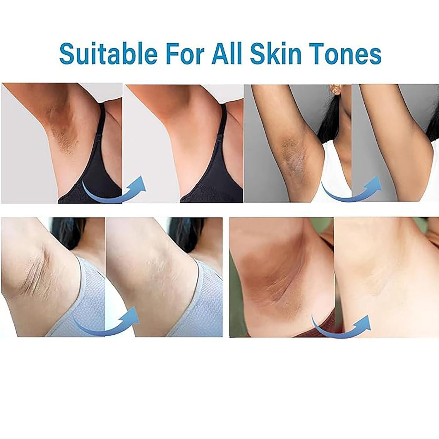 Ceavo Skin Whitening Cream Skin Bleaching Cream for Body Intimate Area, Private Parts, Underarm, Knees, Elbows, Inner Thigh, Bikini Areas, Bikini Line, Lightening Cream Dark Spot Remover For Intimate Areas