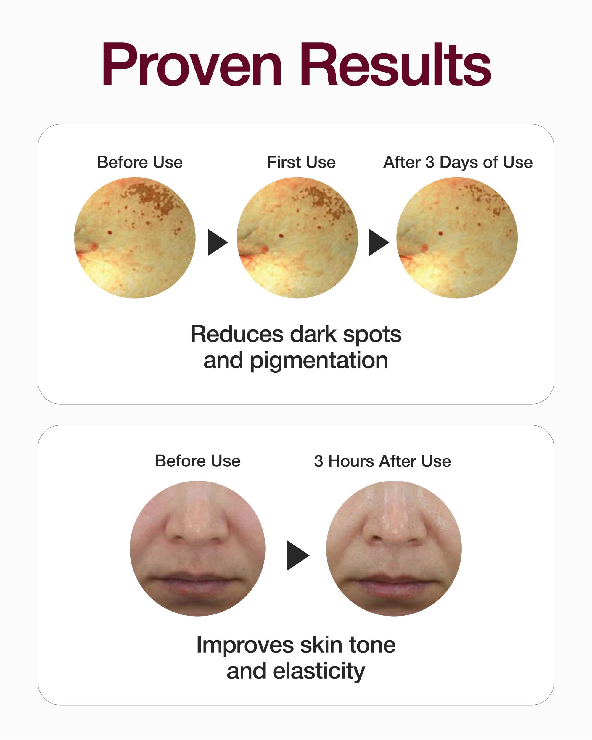 CENTELLIAN 24 Centellian 24 Expert Madeca Mela Capture Ampoule Max (0.5fl oz) - High Concentration Serum for Melanin Reduction, Wrinkle & Enhanced Skin Elasticity, Korean Skin Care. TECA Centella Asiatica Extract