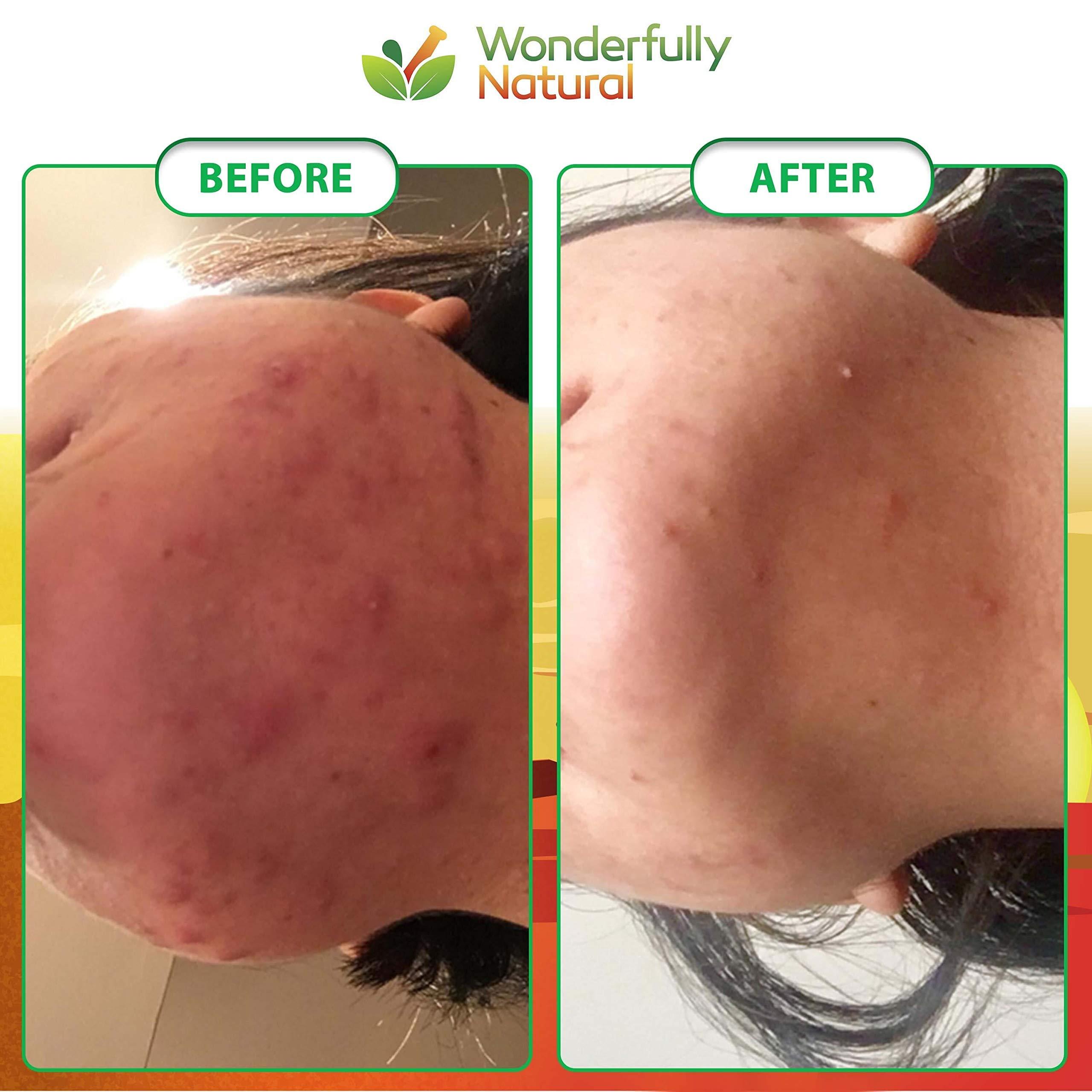 Wonderfully Natural Organic African Black Soap - For Acne & Dark Spots | Natural Vegan and Cruelty Free Satisfaction Guarantee 1lb bar | 90 day Supply