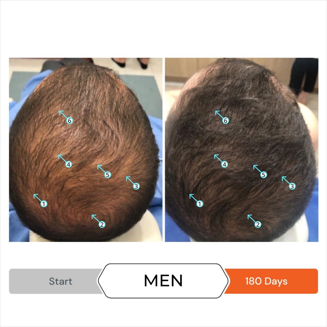 DS Laboratories DS Laboratories Revita Shampoo & Tablets - Hair Regrowth Treatment and Thickening Products for Thinning or Shedding Hair