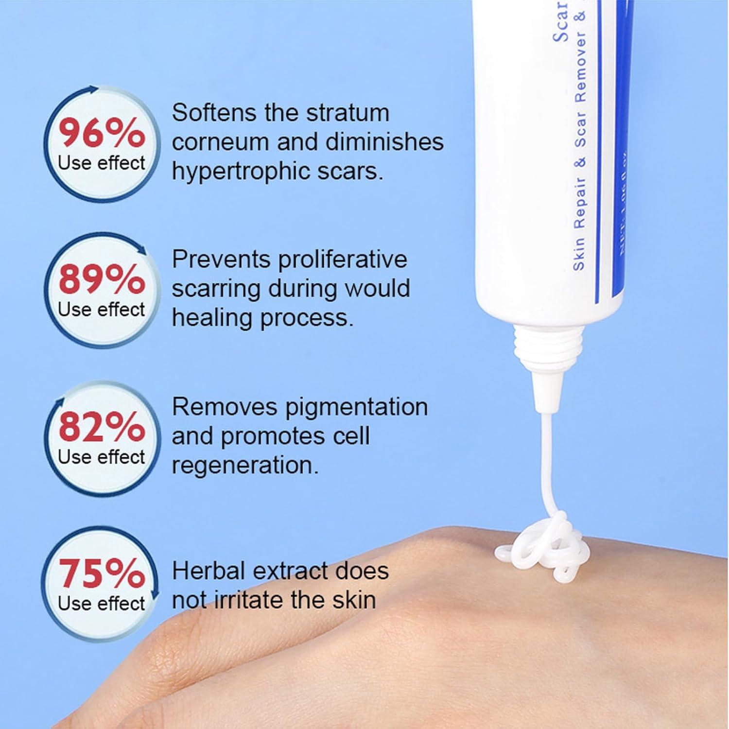 Generic Advanced Scar Cream Gel, Scar Removal Cream for Skin Face Body, Medical-Grade Silicone Gel Treatments for Keloid C-Section Acne Surgical Burns Stretch Marks - Old and New Scars 1.0 oz (1 PCS)