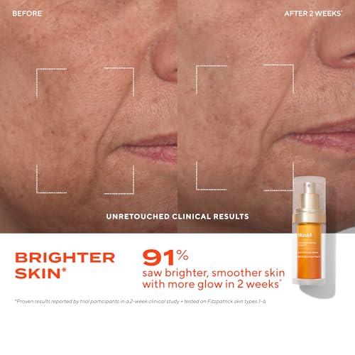 Murad Murad Vita-C Glycolic Serum - Environmental Shield Skin Brightening Vitamin C Face Serum - Hyperpigmentation Treatment Backed by Science, Travel .33 Fl Oz